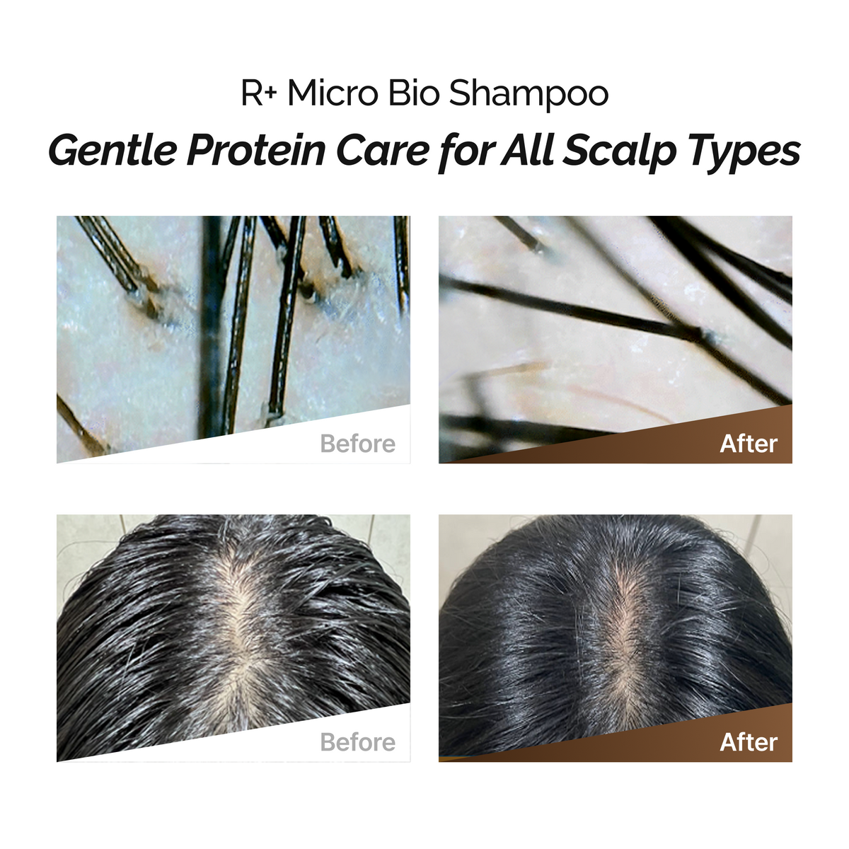 ROOTONIX R Micro Bio Shampoo